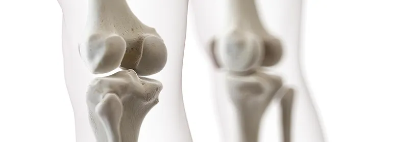 Calcium is all you need to maintain healthy bones